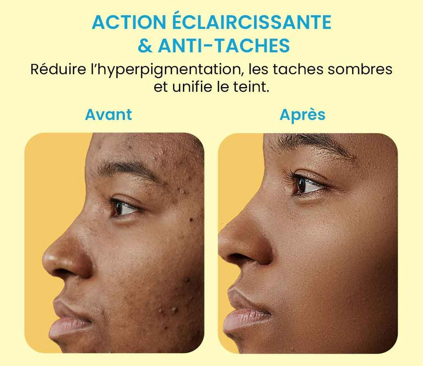 Tampons nettoyants au Curcuma et à l'Acide Kojique